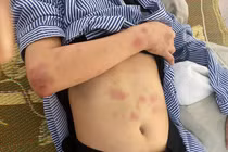 Gã trai đánh cô gái suốt 2 giờ đối mặt hình phạt nào?