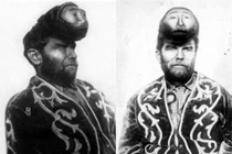 Cuộc đời của “dị nhân 2 đầu” đặc biệt nhất thế kỷ 20