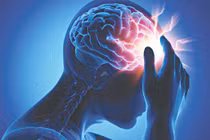 Đau đầu, mệt mỏi khi trời “ẩm ương”, coi chừng dấu hiệu đột quỵ