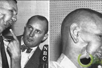 Khó tin tử tù bị bắn 9 phát súng vào đầu vẫn thoát chết