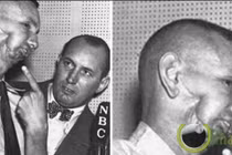 Khó tin tử tù bị bắn 9 phát súng vào đầu vẫn thoát chết