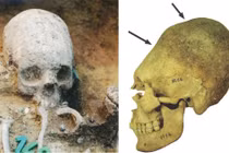 Sự thật chấn động 51 hộp sọ bị kéo dài ở Hungary