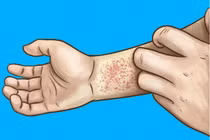 Cơ thể xuất hiện 5 dấu hiệu này chứng tỏ thận bạn đang “kêu cứu” 