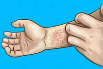 Cơ thể xuất hiện 5 dấu hiệu này chứng tỏ thận bạn đang “kêu cứu” 