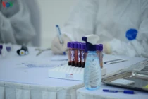 Hà Nội test nhanh 5.222 mẫu cho những người đến Bệnh viện Bạch Mai