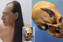 Kiểm tra hộp sọ chiến binh 2.000 tuổi, lộ bí mật động trời 