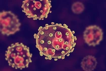 Top 8 loại virus nguy hiểm nhất hành tinh, đoạt mạng người hàng loạt