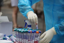 Đà Nẵng sẽ xét nghiệm COVID-19 theo nhóm