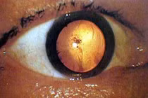 11 bức hình ám ảnh chứa bí mật khủng khiếp nhất lịch sử 