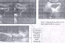 Suýt mất mạng vì những kiểu chữa bệnh quái đản