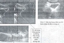 Suýt mất mạng vì những kiểu chữa bệnh quái đản