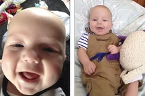 Xót xa bé 8 tháng tuổi qua đời vì viêm màng não