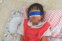 Giáo viên trói tay, bịt mắt 2 bé gái trong lớp gây phẫn nộ