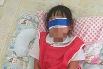 Giáo viên trói tay, bịt mắt 2 bé gái trong lớp gây phẫn nộ