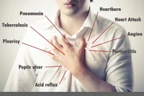 Giải mã lý do khiến bạn bị đau nhói ở ngực