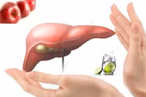 Uống thuốc gì để giải độc gan sau những ngày Tết?