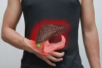 Cứ tăng cân béo phì là chắc chắn mắc phải bệnh sau