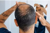 Triệu chứng ít người biết của bệnh tiểu đường