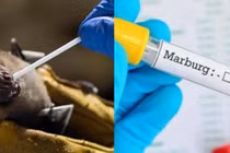 Loại virus khiến WHO họp khẩn có khả năng lây sang Việt Nam không?