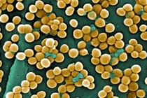 Tụ cầu vàng có thể gây tử vong: Phòng tránh thế nào?