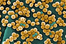 Tụ cầu vàng có thể gây tử vong: Phòng tránh thế nào?