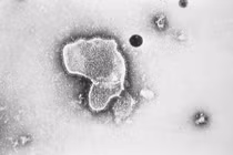 Virus hợp bào hô hấp gây bệnh ở trẻ nguy hiểm sao?