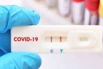 Ca mắc COVID-19 tăng nhanh: Phó Giám đốc CDC Hà Nội lý giải
