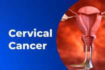 Ung thư cổ tử cung gây tử vong: Ai dễ mắc bệnh hơn?
