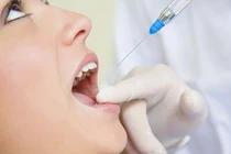 Ngộ độc thuốc tê dễ gây tử vong: Ai có nguy cơ cao?