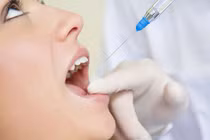 Ngộ độc thuốc tê dễ gây tử vong: Ai có nguy cơ cao?