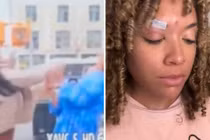 Đang phỏng vấn, nữ phóng viên bị tấn công dã man giữa phố