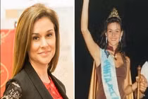 Bi kịch hoa hậu tài năng qua đời sau phẫu thuật thẩm mỹ