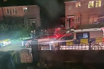 Kinh hãi cô gái 19 tuổi bị chó dữ cắn tử vong tại nhà