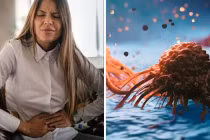 Tỷ lệ ung thư tuyến tụy tăng nhanh nhất ở nhóm người này