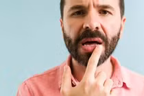 Thấy dấu hiệu này trên môi, coi chừng ung thư da