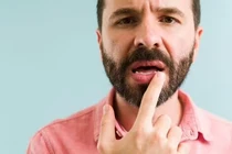 Thấy dấu hiệu này trên môi, coi chừng ung thư da