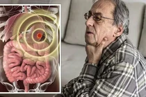 Dấu hiệu nấc cụt liên quan đến đột quỵ hoặc ung thư