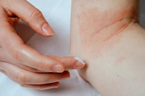 Loạt vụ thu hồi mỹ phẩm chăm sóc da không đạt chất lượng