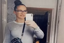 Người phụ nữ bị chó nhà cắn tử vong