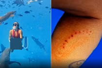 Hãi hùng khoảnh khắc người phụ nữ bị cá mập cắn khi đang lặn