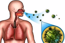 Dấu hiệu nhận biết sớm bệnh bạch hầu nguy hiểm