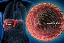 Cách nhận biết triệu chứng virus viêm gan có thể gây tử vong