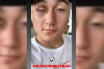 Văn Lâm khoe mắt thâm trên mạng xã hội