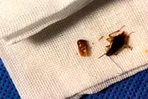 Kinh hoàng người đàn ông bị cả chục con gián làm tổ trong tai