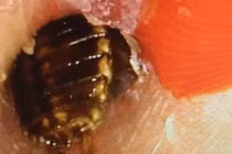 Nửa đêm bé trai không ngừng la hét, đánh vào đầu vì gián bò vào tai