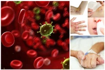 Những dấu hiệu sớm giúp bạn "chặn cửa" ung thư máu nguy hiểm