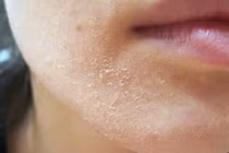 Không muốn bị đột quỵ khi đi tắm mùa đông, cần chú ý những gì?