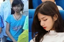 Nhờ niềng răng, cô bé đen nhẻm lột xác thành hot girl khai giảng
