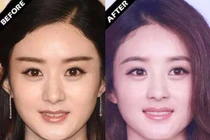Loạt sao Hoa ngữ thăng hạng nhan sắc bội phần chỉ với vài đường kẻ