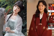 Con gái nuôi của Châu Tinh Trì mặt biến dạng vì thẩm mỹ